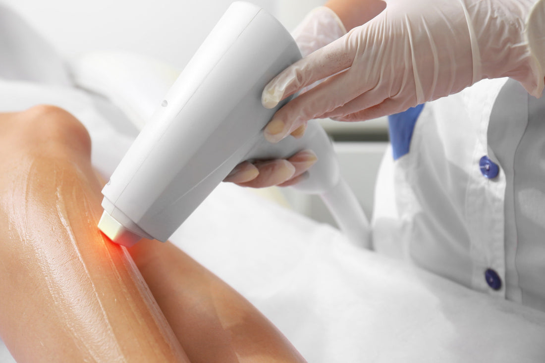 Épilation laser : combien de séances pour un résultat durable ?